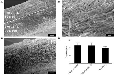 Electrospun PCL/PLA Scaffolds Are More Suitable Carriers of Placental Mesenchymal Stromal Cells Than Collagen/Elastin Scaffolds and Prevent Wound Contraction in a Mouse Model of Wound Healing